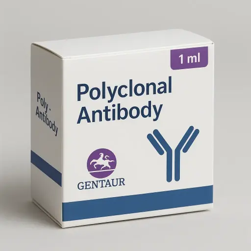 (KO Validated) OXCT1 Polyclonal Antibody